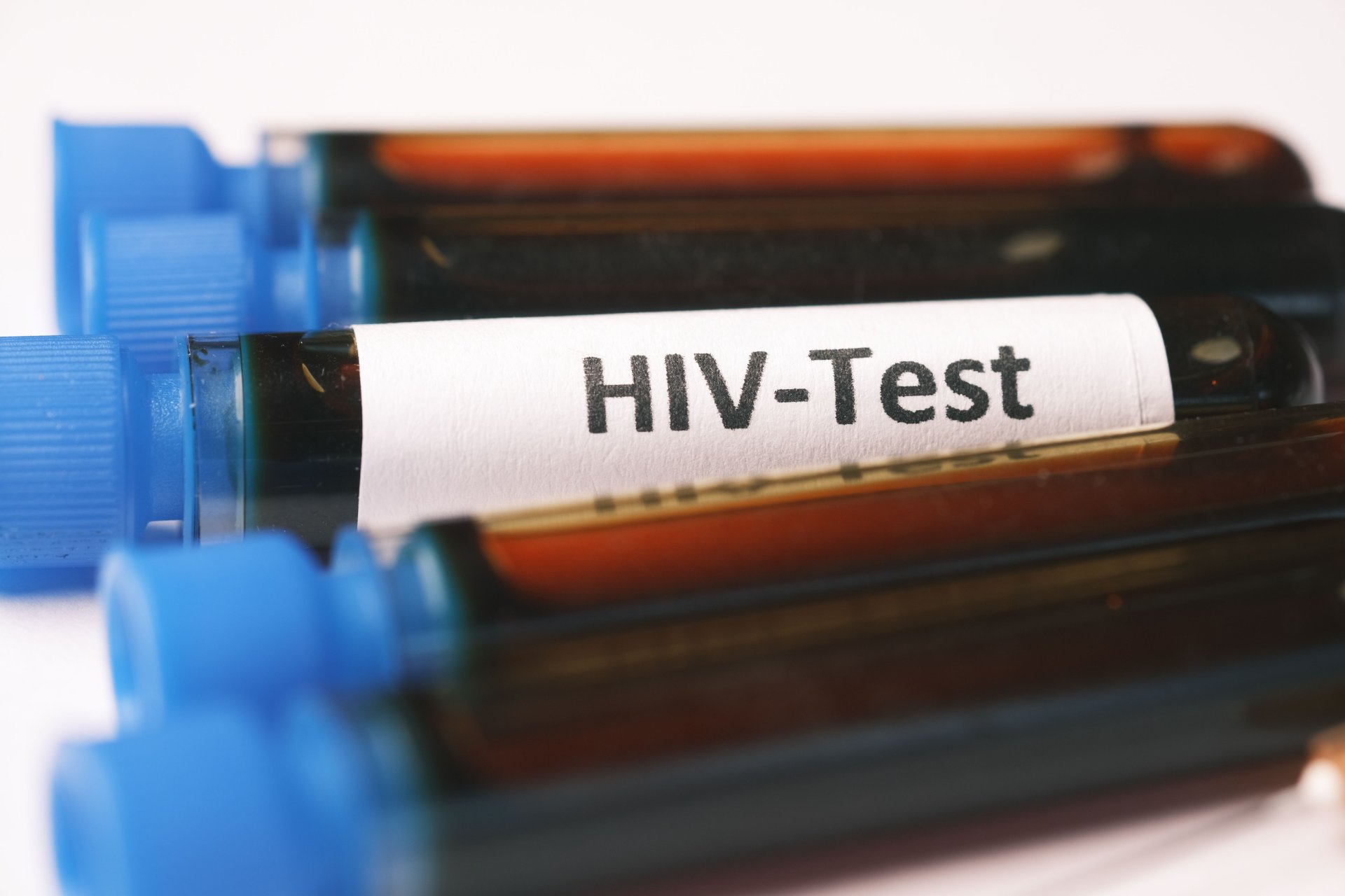 HIV Testi